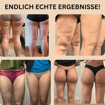 #1  3D Anti-Cellulite Leggings